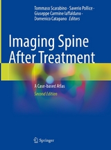 Imaging Spine After Treatment - 