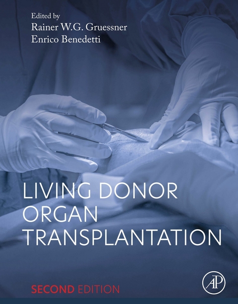 Living Donor Organ Transplantation - 