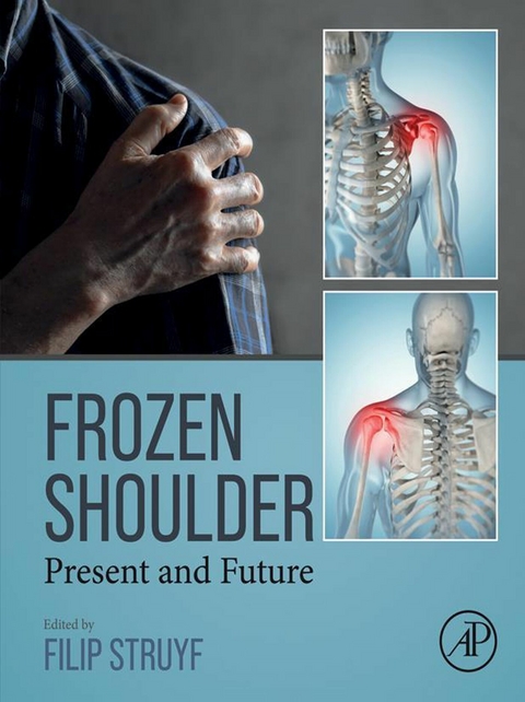 Frozen Shoulder - 