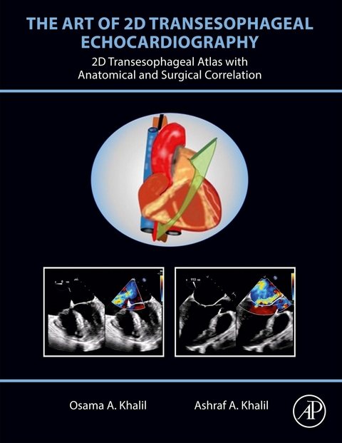 Art of 2D Transesophageal Echocardiography -  Ashraf A. Khalil,  Osama A. Khalil