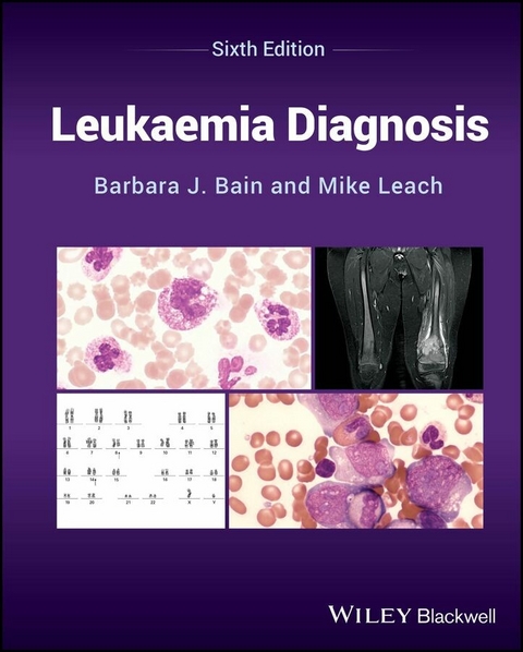 Leukaemia Diagnosis -  Barbara J. Bain,  Mike Leach