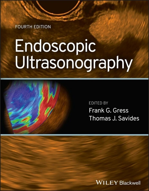 Endoscopic Ultrasonography - 