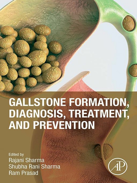 Gallstone Formation, Diagnosis, Treatment and Prevention - 
