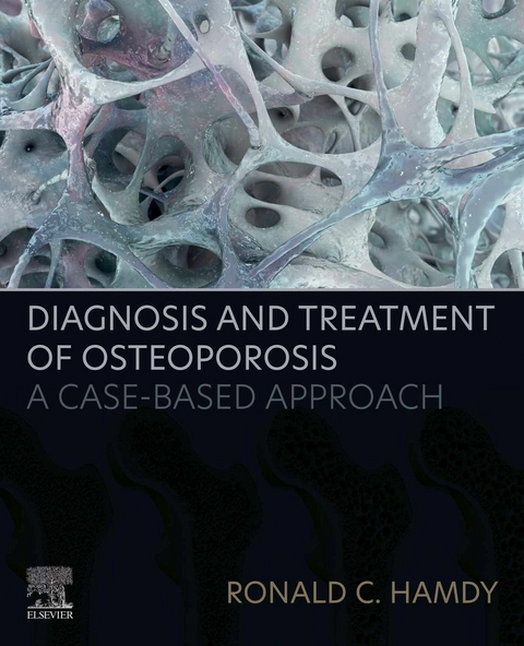 Diagnosis and Treatment of Osteoporosis -  Ronald C. Hamdy