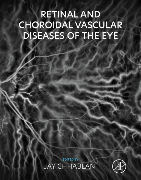 Retinal and Choroidal Vascular Diseases of the Eye - 