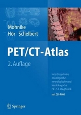 PET/CT-Atlas - Mohnike, Wolfgang; Hör, Gustav; Schelbert, Heinrich