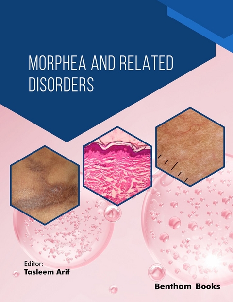 Morphea and Related Disorders - 