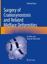 Surgery of Craniosynostosis and Related Midface Deformities - Michael Rasse