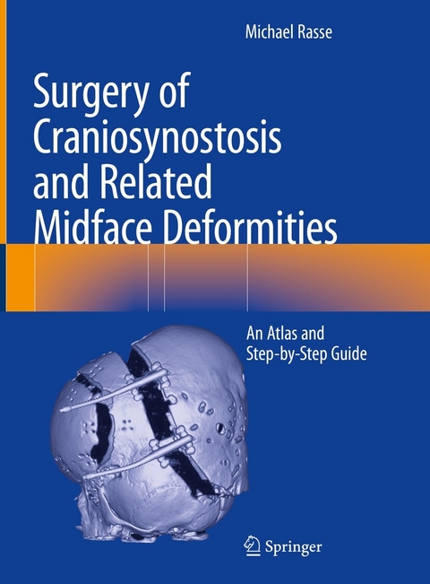 Surgery of Craniosynostosis and Related Midface Deformities -  Michael Rasse