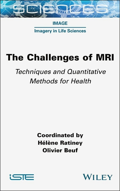 Challenges of MRI - 