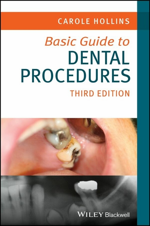 Basic Guide to Dental Procedures -  Carole Hollins