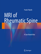 MRI of Rheumatic Spine - Paola D’Aprile