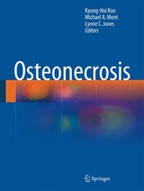 Osteonecrosis - 