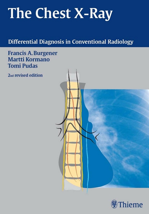 The Chest X-Ray -  Francis A. Burgener,  Martti Kormano,  Tomi Pudas