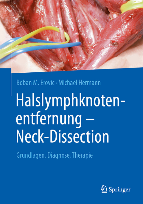 Halslymphknotenentfernung - Neck-Dissection -  Boban M. Erovic,  Michael Hermann