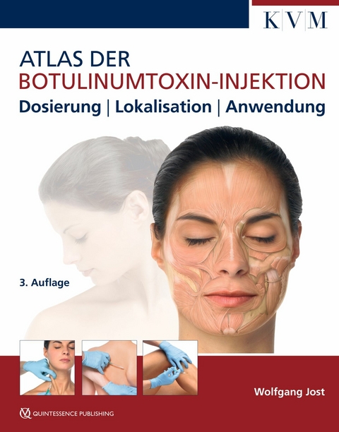 Atlas der Botulinumtoxin-Injektion -  Wolfgang Jost