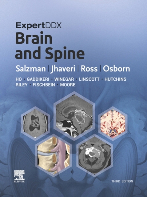 ExpertDDx: Brain and Spine E-Book -  Miral D. Jhaveri,  Jeffrey S. Ross,  Karen L. Salzman