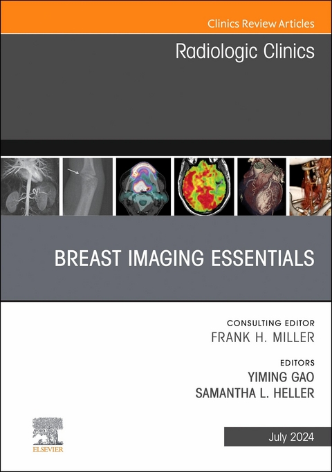 Breast Imaging Essentials, An Issue of Radiologic Clinics of North America, E-Book - 