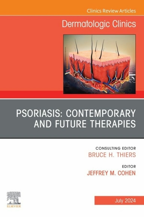 Psoriasis: Contemporary and Future Therapies, An Issue of Dermatologic Clinics, E-Book - 
