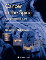 Cancer in the Spine - 