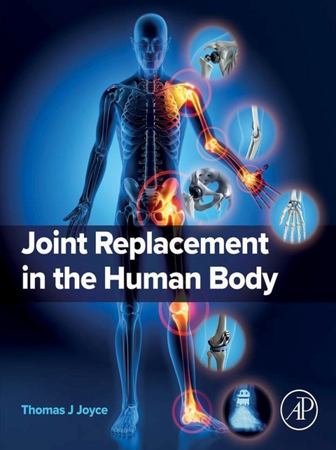 Joint Replacement in the Human Body -  Thomas J Joyce