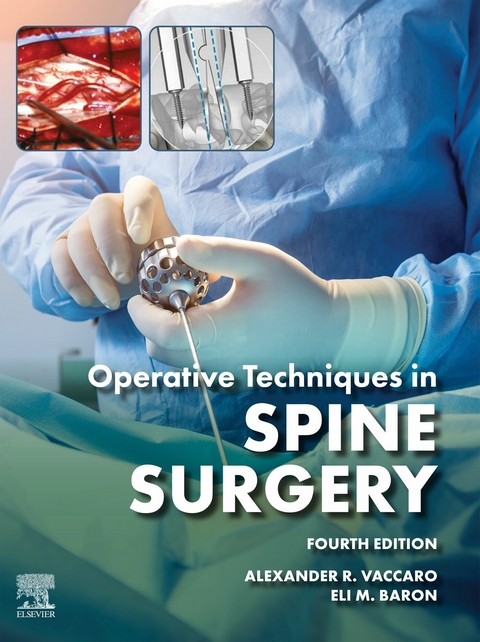 Operative Techniques: Spine Surgery - 