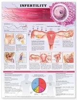 Infertility Anatomical Chart - 