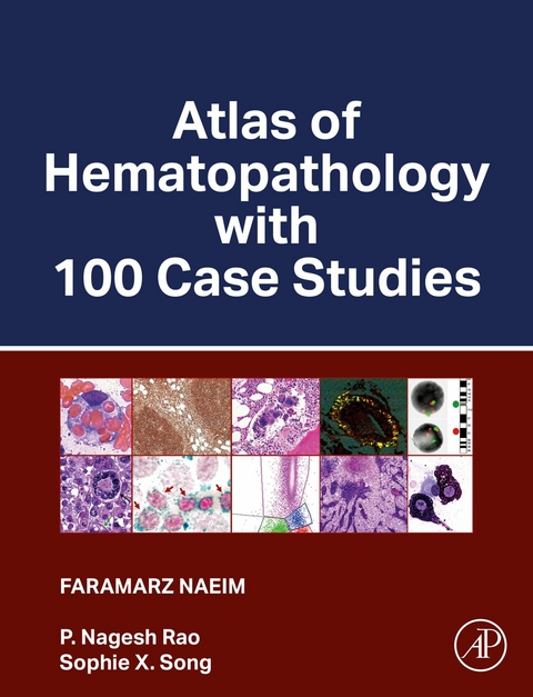 Atlas of Hematopathology with 100 Case Studies -  Faramarz Naeim,  P. Nagesh Rao,  Sophie X. Song