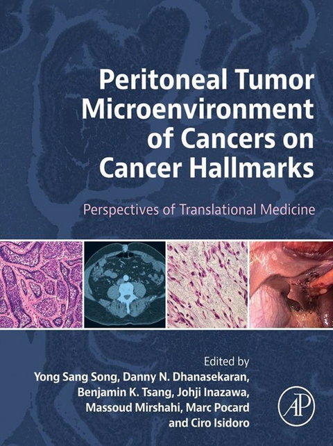 Peritoneal Tumor Microenvironment of Cancers on Cancer Hallmarks - 
