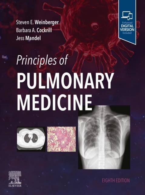 Principles of Pulmonary Medicine - E-Book -  Barbara A. Cockrill,  Jess Mandel,  Steven E. Weinberger