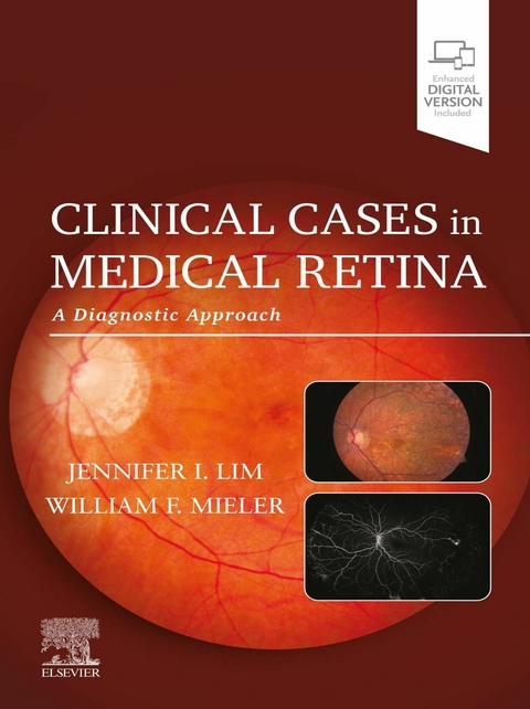 Clinical Cases in Medical Retina - 