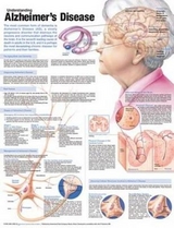 Understanding Alzheimer's Disease Anatomical Chart - 