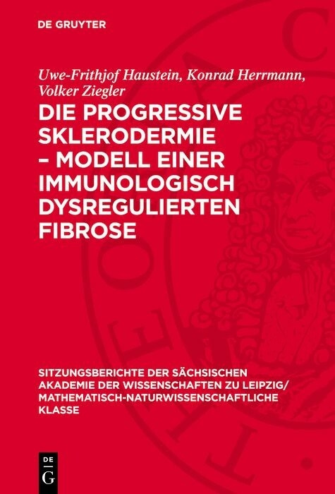 Die progressive Sklerodermie - Modell einer immunologisch dysregulierten Fibrose -  Uwe-Frithjof Haustein,  Konrad Herrmann,  Volker Ziegler