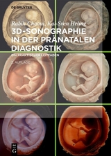 3D-Sonographie in der pränatalen Diagnostik - Rabih Chaoui, Kai-Sven Heling