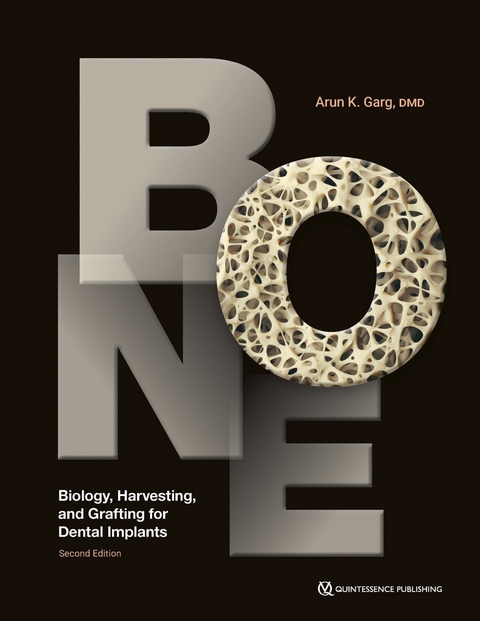 Bone -  Arun K. Garg