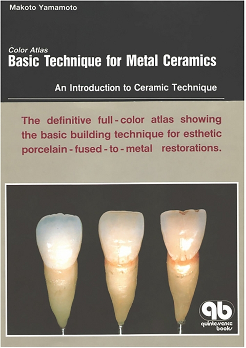 Color Atlas Basic Technique for Metal Ceramics - Makoto Yamamoto