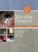 Macular Surgery - Quiroz-Mercado, Hugo; Kerrison, John B.; Alfaro, D.Virgil; Mieler, William F.; Liggett, Peter E.