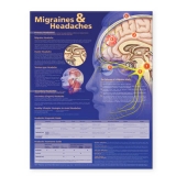 Migraines and Headaches Anatomical Chart - 