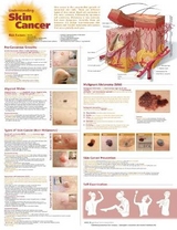 Understanding Skin Cancer Anatomical Chart - 