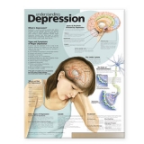 Understanding Depression Anatomical Chart - 