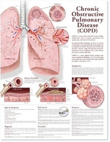 Chronic Obstructive Pulmonary Disease Anatomical Chart - 