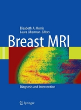 Breast MRI - 