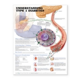 Understanding Type 1 Diabetes Anatomical Chart - 