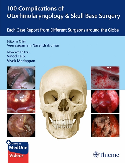 100 Complications of Otorhinolaryngology & Skull Base Surgery - 