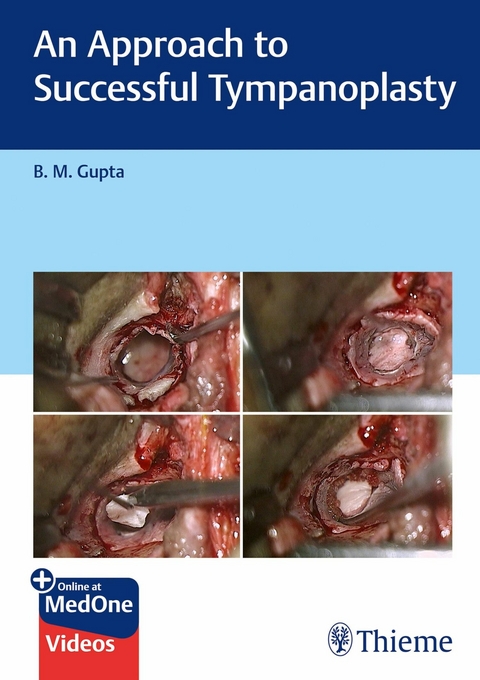 Approach to Successful Tympanoplasty -  B M Gupta