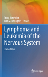 Lymphoma and Leukemia of the Nervous System - 