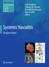 Systemic Vasculitis - 