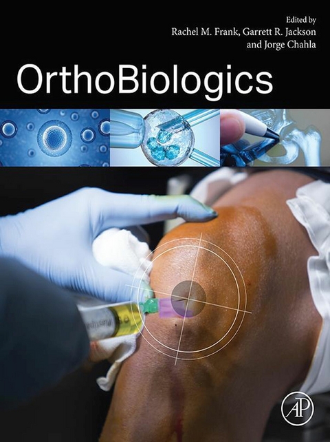 OrthoBiologics - 