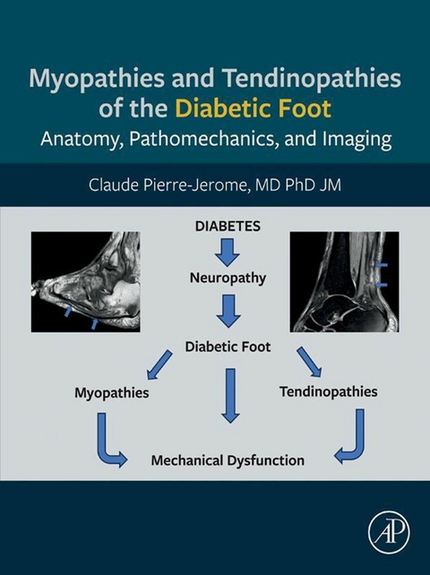 Myopathies and Tendinopathies of the Diabetic Foot -  Claude Pierre-Jerome