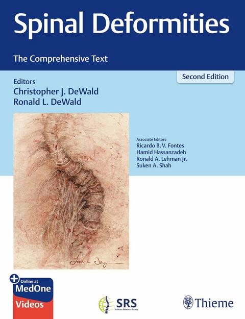 Spinal Deformities -  Christopher DeWald,  Ronald L. DeWald